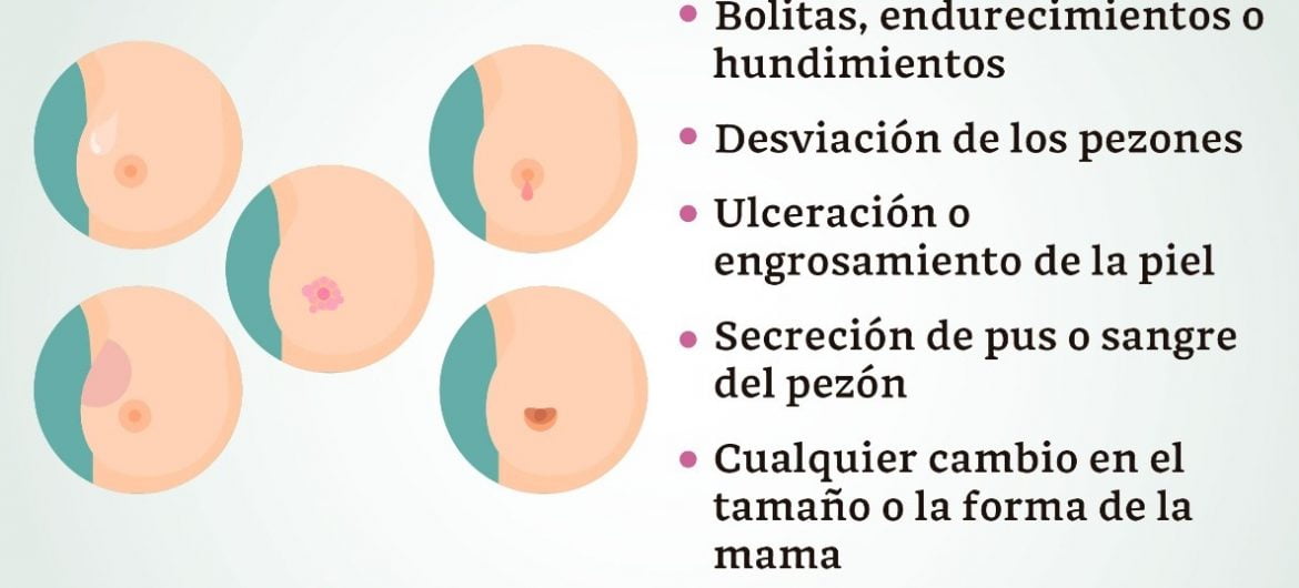 Imagen: Secretaría de Salud del Gobierno de la Ciudad de México.