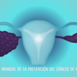 Cáncer de ovario: 75% de los casos se detectan en etapa avanzada