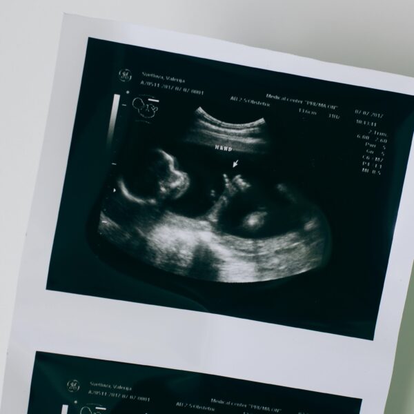 ¿Te traumaron con el feto ingeniero? Desmitificando la narrativa de propaganda antiaborto