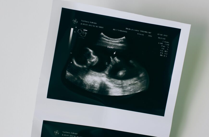 ¿Te traumaron con el feto ingeniero? Desmitificando la narrativa de propaganda antiaborto